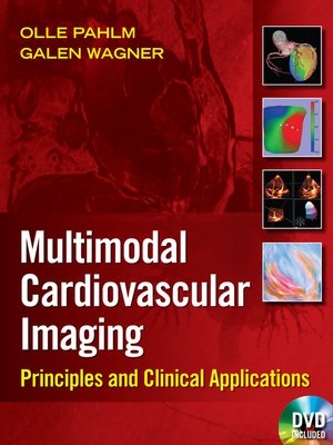 cover image of Multimodal Cardiovascular Imaging